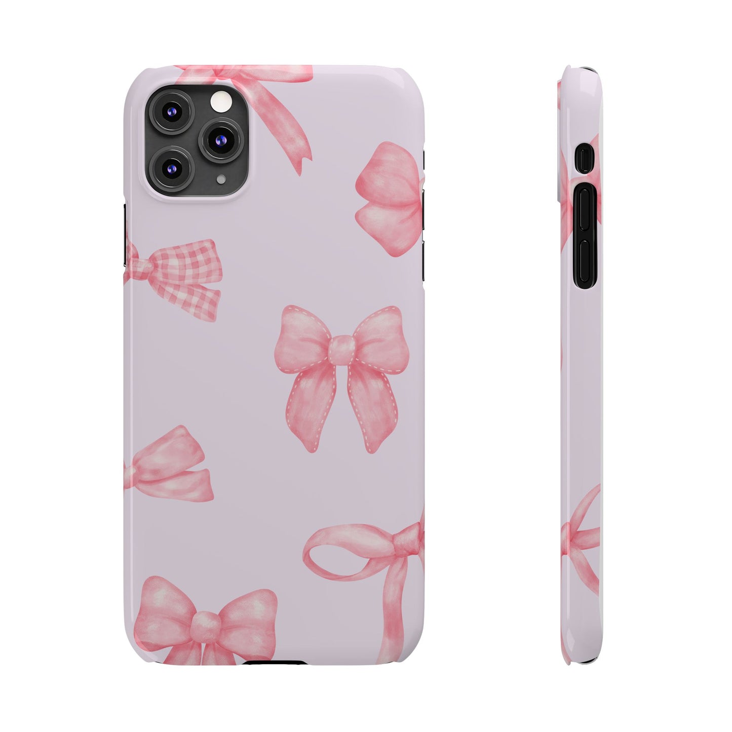 Bows Case